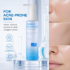 Solumart Acne - Prone Facial Cleanser - Image 6
